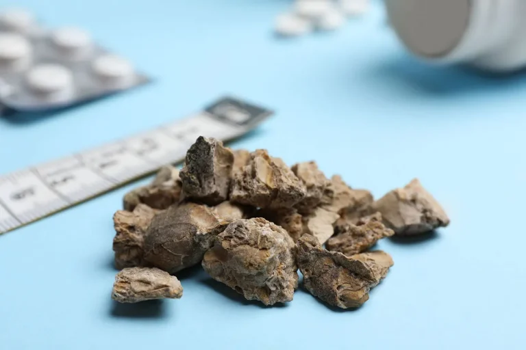 How Much Are Kidney Stones Worth? A Detailed Look At Their Value